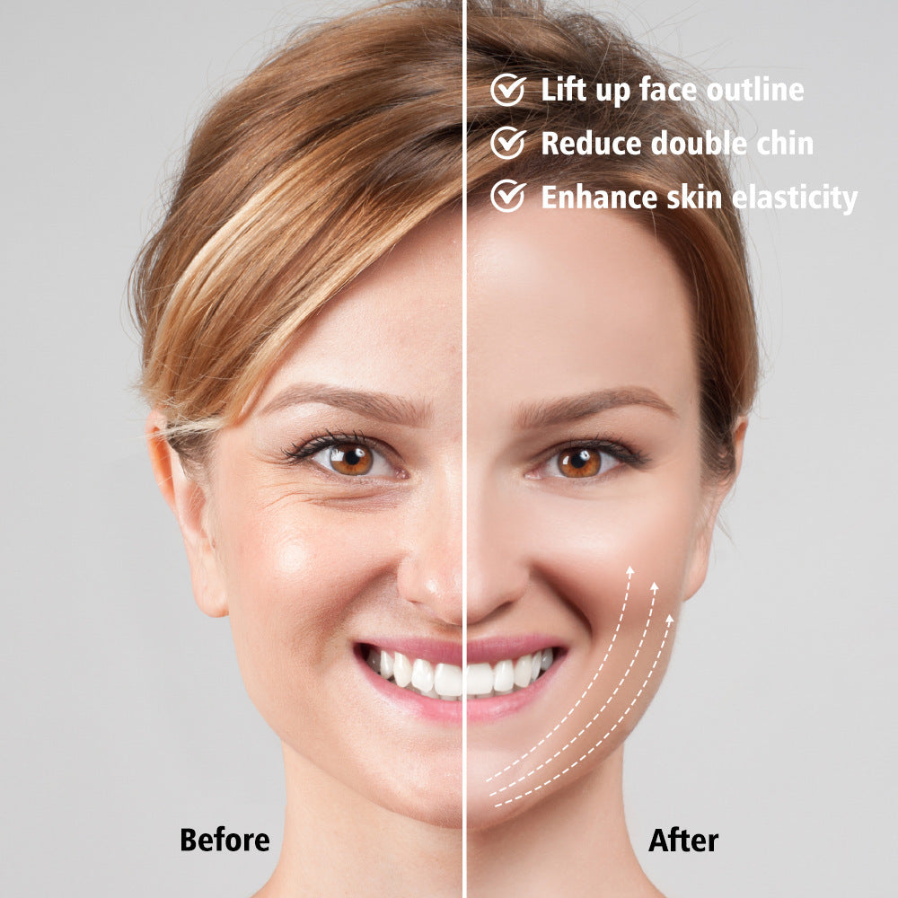 V Facial Lifting Device Image 8