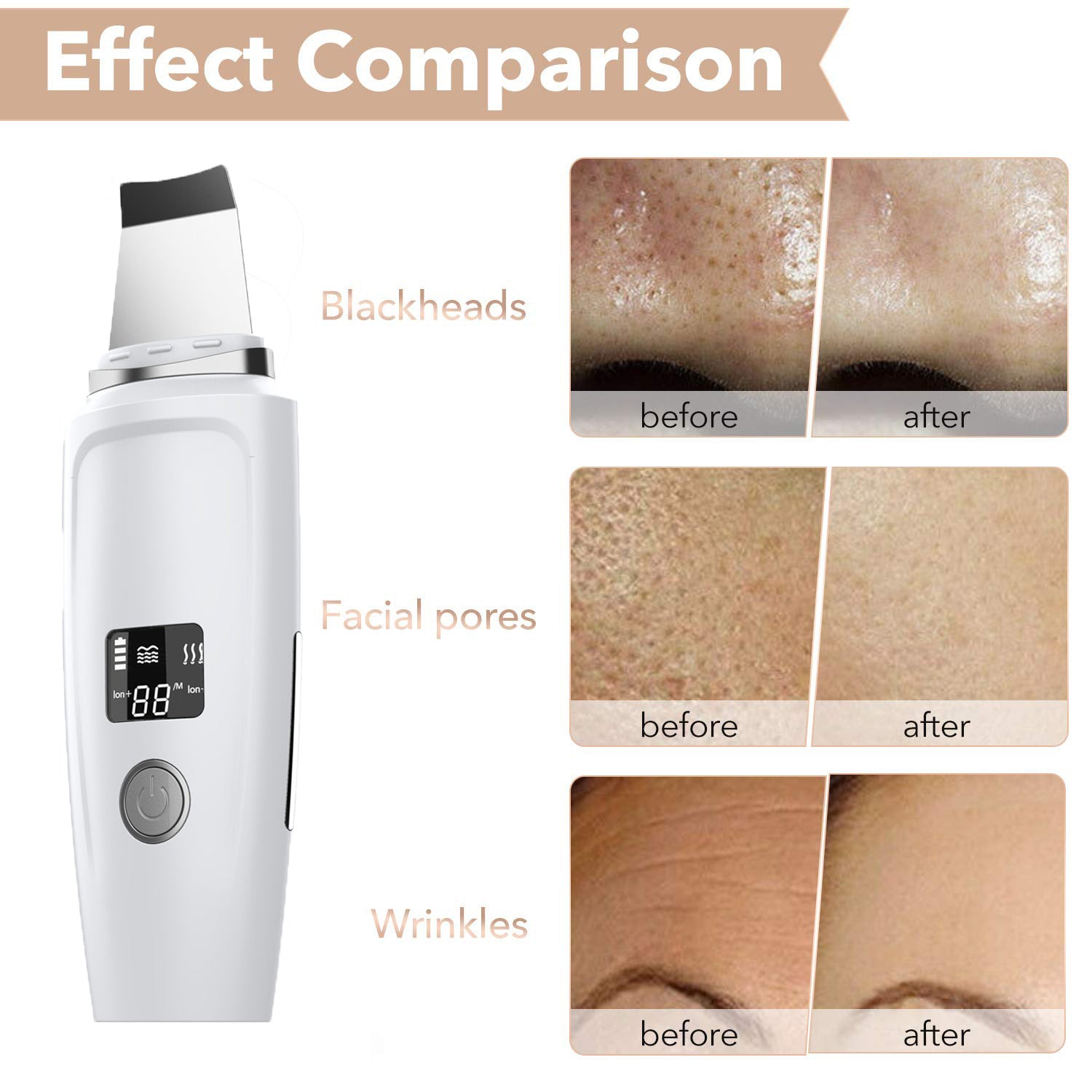 Home skincare tool for deep cleansing